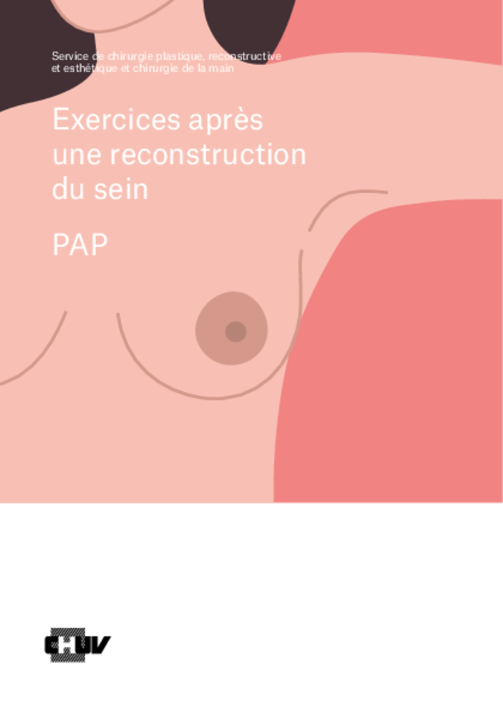 Exercices après une reconstruction du sein - PAP
